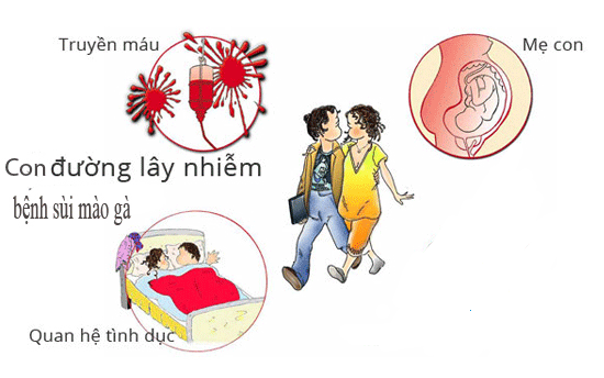 Con đường lây nhiễm sùi mào gà như thế nào?